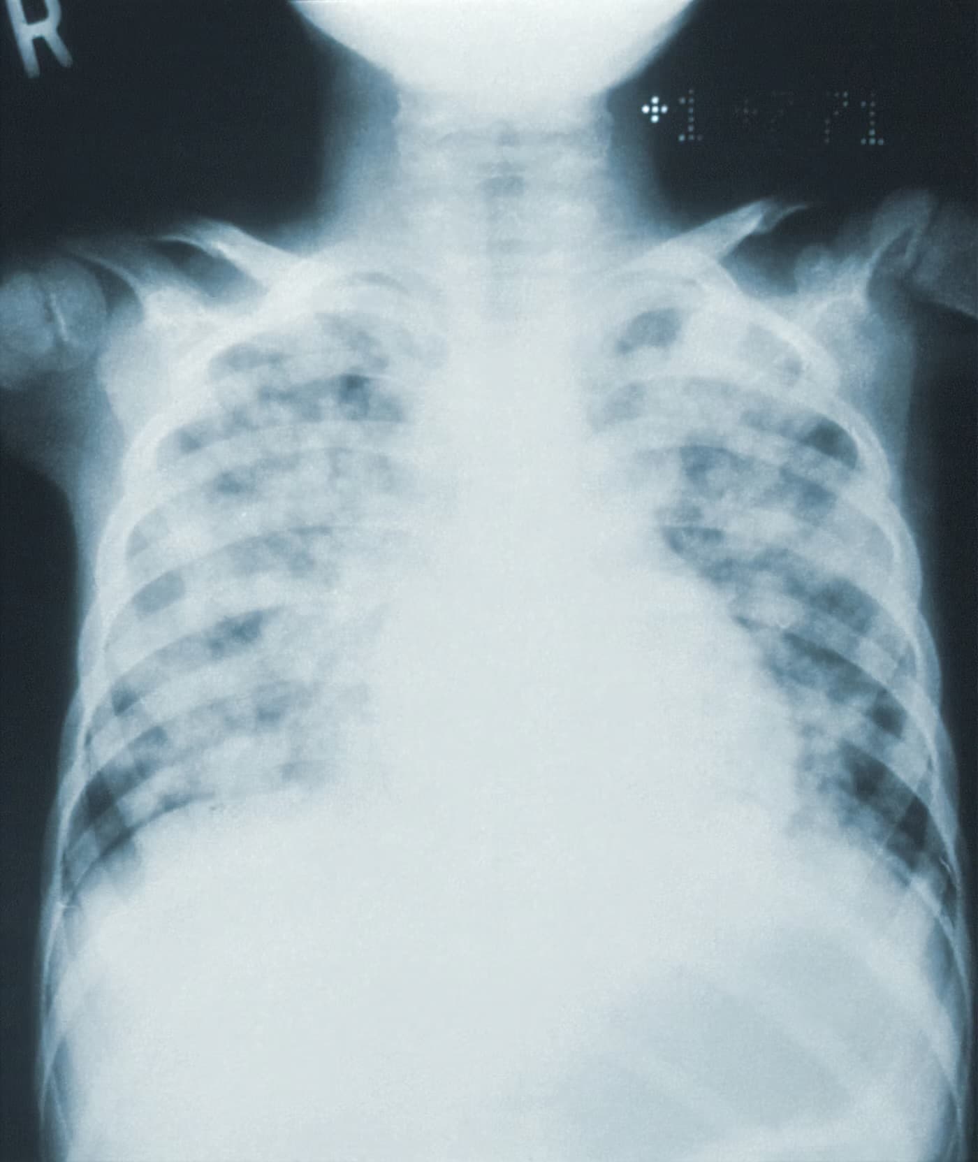 X Ray